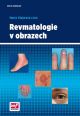 V�ce informac� o v�robku Revmatologie v obrazech
