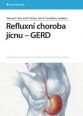 V�ce informac� o v�robku Refluxn� choroba j�cnu - GERD