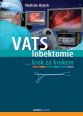 V�ce informac� o v�robku VATS lobektomie krok za krokem
