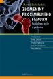 V�ce informac� o v�robku Zlomeniny proxim�ln�ho femuru - Komplexn� p��e o pacienta
