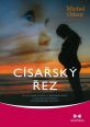 V�ce informac� o v�robku C�sa�sk� �ez - Co je dobr� v�d�t o c�sa�sk�m �ezu a jak souvis� porod se schopnost� milovat